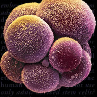 Timeline: Stem Cells