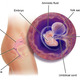 Annotated fetus 1m