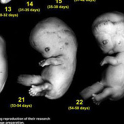Timeline: Prenatal Development