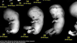 Timeline: Prenatal Development