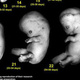 Prenatal development