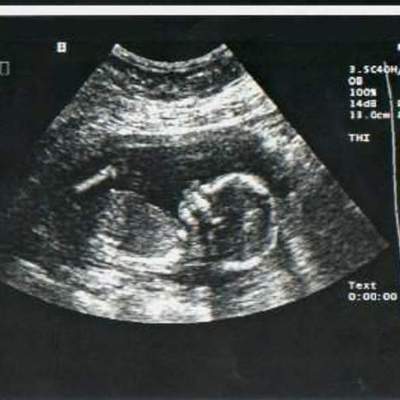 Timeline: Parental Development