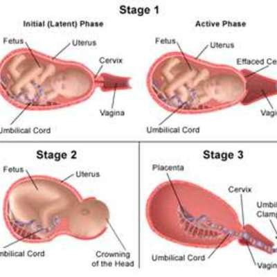 Timeline: Labor to Birth
