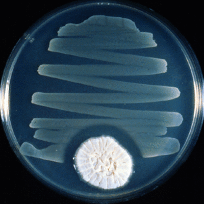 Timeline: Penicillin and its history