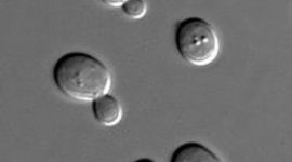 Timeline: CATALASE ASSAY