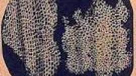 Timeline: Germ Theory Of Disease: A Revolution in Medicine