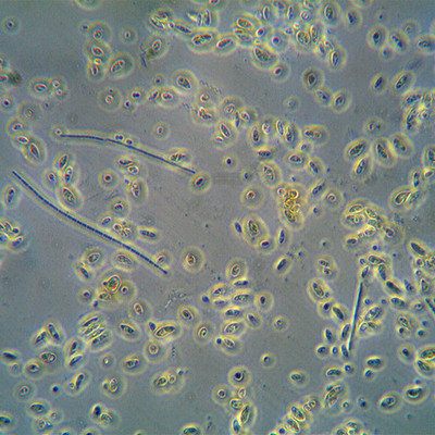 Timeline: Germ Theory Of Disease Year Only Timeline
