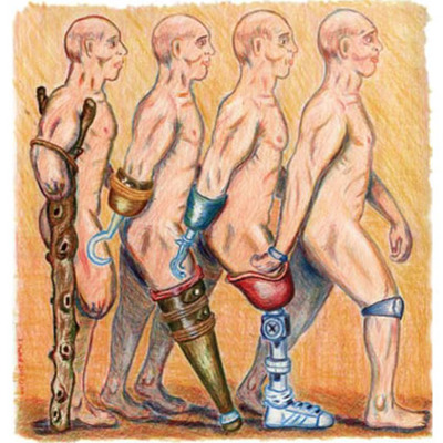 Timeline: The History of Prosthetics- Then to Now