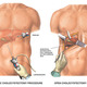 Laparoscopic1