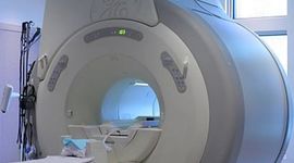 Timeline: Types of screenings