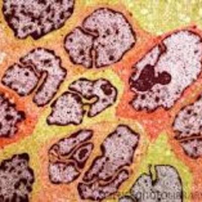 Timeline: Cancer Screenings