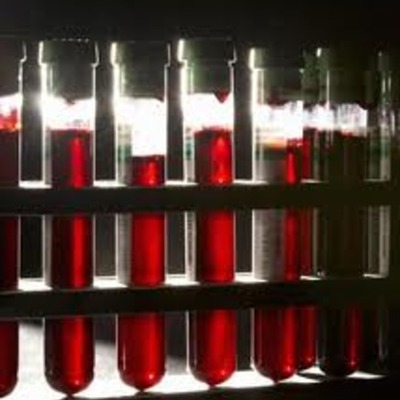 Timeline: Routine Cancer Screenings