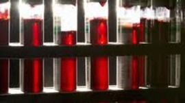 Timeline: Routine Cancer Screenings