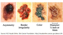 Timeline: Cancer Screenings