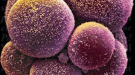 Timeline: Stem Cell History