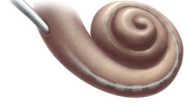 Timeline: Dr. Grame Clark (cochlear)