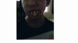 Timeline: Zach Bauer