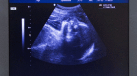 Timeline: ETAPAS IMPORTANTES DE MI VIDA