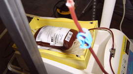 Timeline: If the blood transfusion hadn't invented