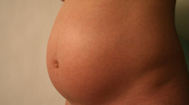 Timeline: Thanet's Teen Pregnancy History