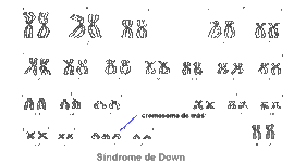 Timeline: Historia del sindrome de down