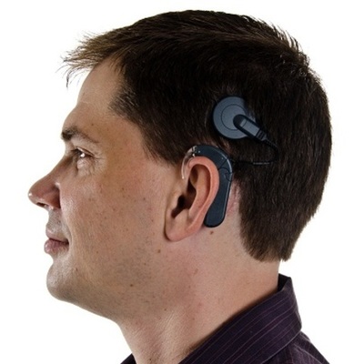 Timeline: Stephen's Cochear Implant Progress