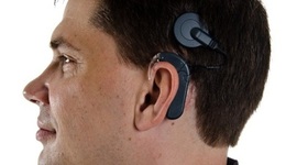 Timeline: Stephen's Cochear Implant Progress