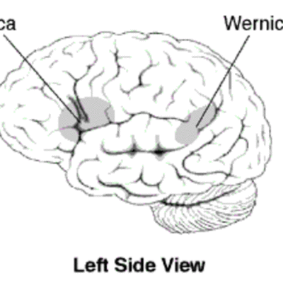 Timeline: Aphasia: A Timeline