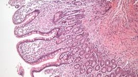 Timeline: Experiencia Educativa: Patología Especial