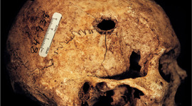 Timeline: Forensics 1920-1945