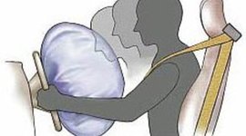 Timeline: Safety Technology in Vehicles