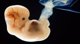 Timeline: Child Development