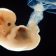 Embryo