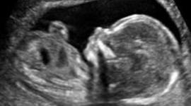 Timeline: Pregnancy and Prenatal Development