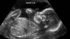 Timeline: Pregnacy and Prenatal Development