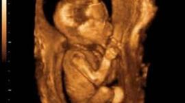 Timeline: Month 1- Mommy