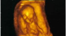 Timeline: Pregancy And Prenatal Dev.