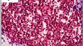 Timeline: GATA2 Development