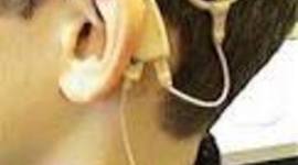 Timeline: History of the Cochlear Implant