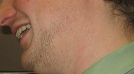 Timeline: revolutionary war