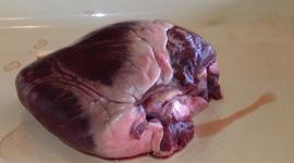 Timeline: Our Nicky's heart