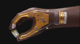 Timeline: Les prothèses au fil des siècles.