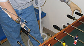 Timeline: History of Upper Body Prosthesis