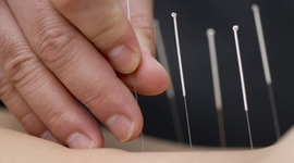 Timeline: Acupuncture: A Walk Through Its History