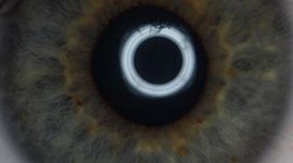 Timeline: Catchlight