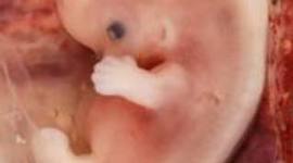 Timeline: Fetal Development Timeline