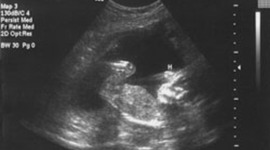 Timeline: Weeks 29-32, Pregnacy development of a baby