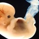 6 week human embryo getty