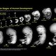 Fetal development