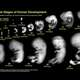 Fetal development